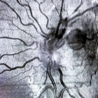 The Eye Site