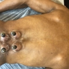 Acupuncture Pain and Stress Center gallery