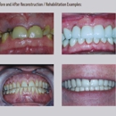 Hampton Family Dentistry - Cosmetic Dentistry