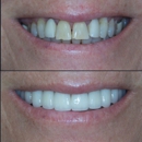 Sycamore Dentistree - Teeth Whitening Products & Services