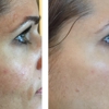 Wispies Lash Bar & Spa gallery