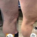 Vein Treatment Center - Medical Clinics