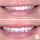Dr. Michaela Tozzi, DMD: Cosmetic Dentistry & Dental Aesthetics