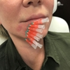 Botox Anonymous gallery