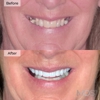 Michigan Dental Studio Rochester gallery