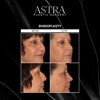 Astra Plastic Surgery - Atlanta gallery