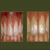 Walker Square Dental gallery