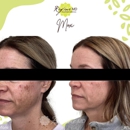 Refine MD - Hair Weaving