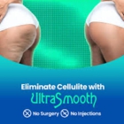 UltraSlim of Vancouver
