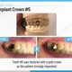 K Family Dentistry General Cosmetic Emergency Implants