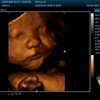 Baby Bee 3D Ultrasound (Fort Worth/NRH) gallery