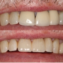 Central Avenue Dentistry - Cosmetic Dentistry