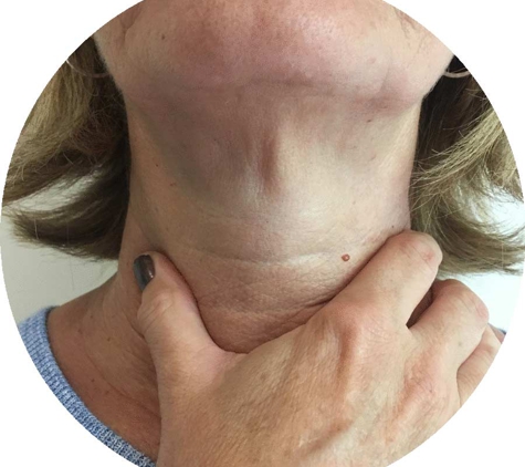 Southern Sydney Voice Therapy
