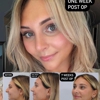 Z Face Plastic Surgery: Dr. Ruslan Zhuravsky gallery