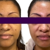 Reign Medical Aesthetics & Wellness - Villages gallery