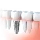 Brandywine Dental Services Group - Orthodontists