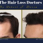 The Hair Loss Doctors