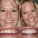 James B. Polley, DDS - Implant Dentistry