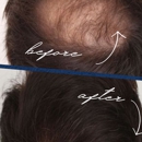 The Hair Loss Doctors By Robert J. Dorin - Surgery Centers