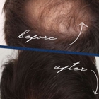 The Hair Loss Doctors