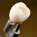 Bluffton Dental Care - Endodontists