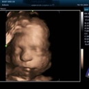 Baby Bee 3D Ultrasound (Fort Worth) - Baby Accessories, Furnishings & Services