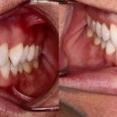 Newman Dental - Implant Dentistry