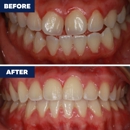 Orthodontics of Torrance - Orthodontists