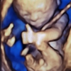 Love At First Sight 3D/4D Ultrasound Imaging Studio gallery
