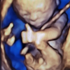 Love At First Sight 3D/4D Ultrasound Imaging Studio