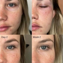 Restoration Medical Aesthetics - Hair Removal