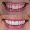 Dentistry of Lawrenceburg gallery