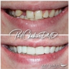 Just Smiles - General, Cosmetic & Implant Dentistry gallery