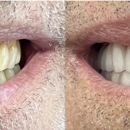 MR Dental Aesthetics - Implant Dentistry