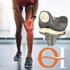 Optimotion Implants gallery