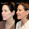 Lindsey Pennington, MD Facial Plastics gallery