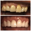 Nuva Smile gallery